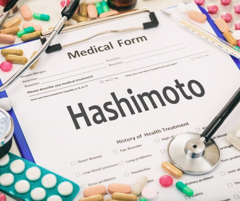Od czego zacząć w chorobie Hashimoto?